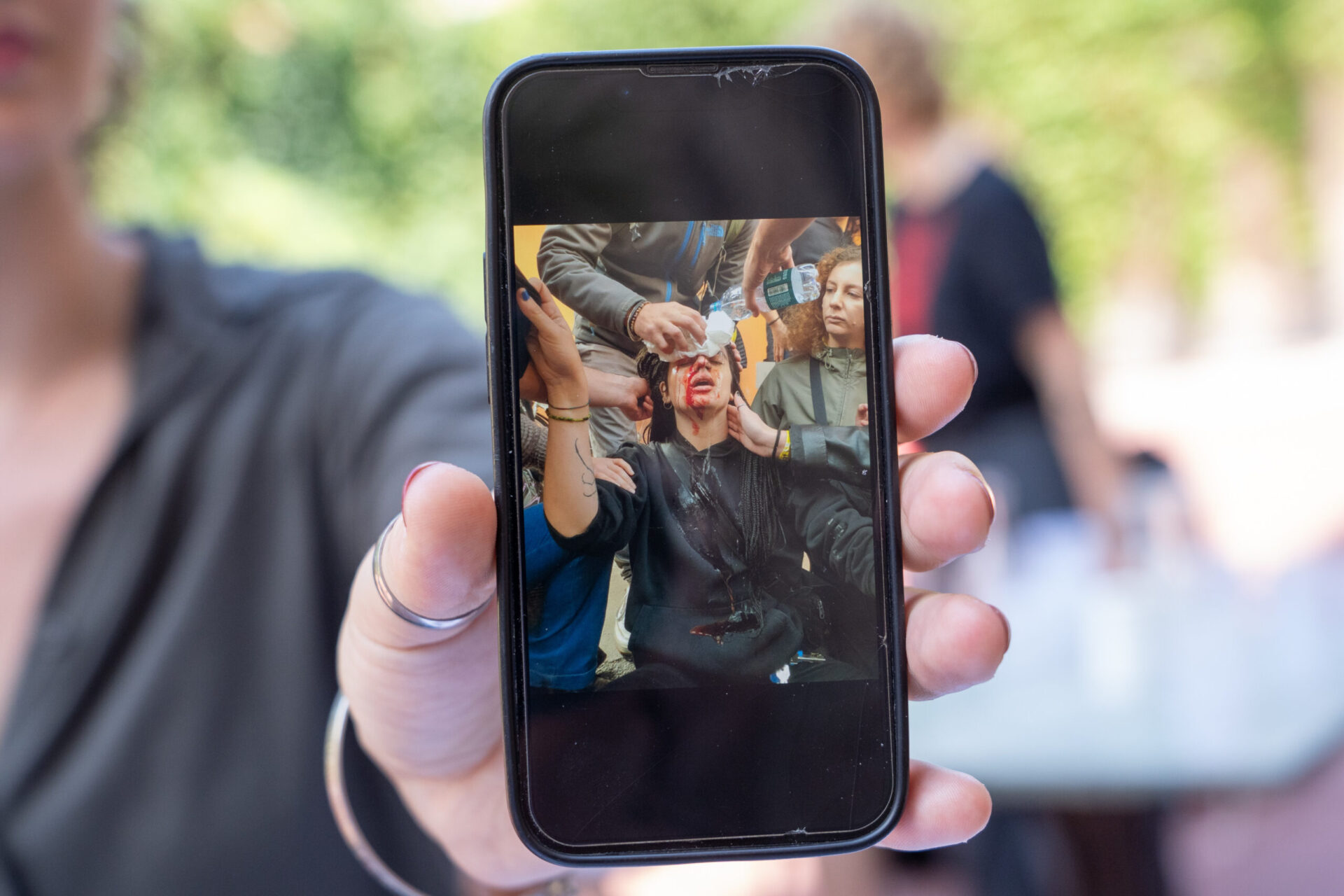 foto-video-|-ragazza-manganellata-a-bologna,-la-procura-vuole-archiviare.-lei-non-ci-sta:-“non-sono-inciampata”